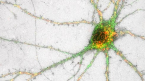 A Potential New Pathway for Parkinson's Disease