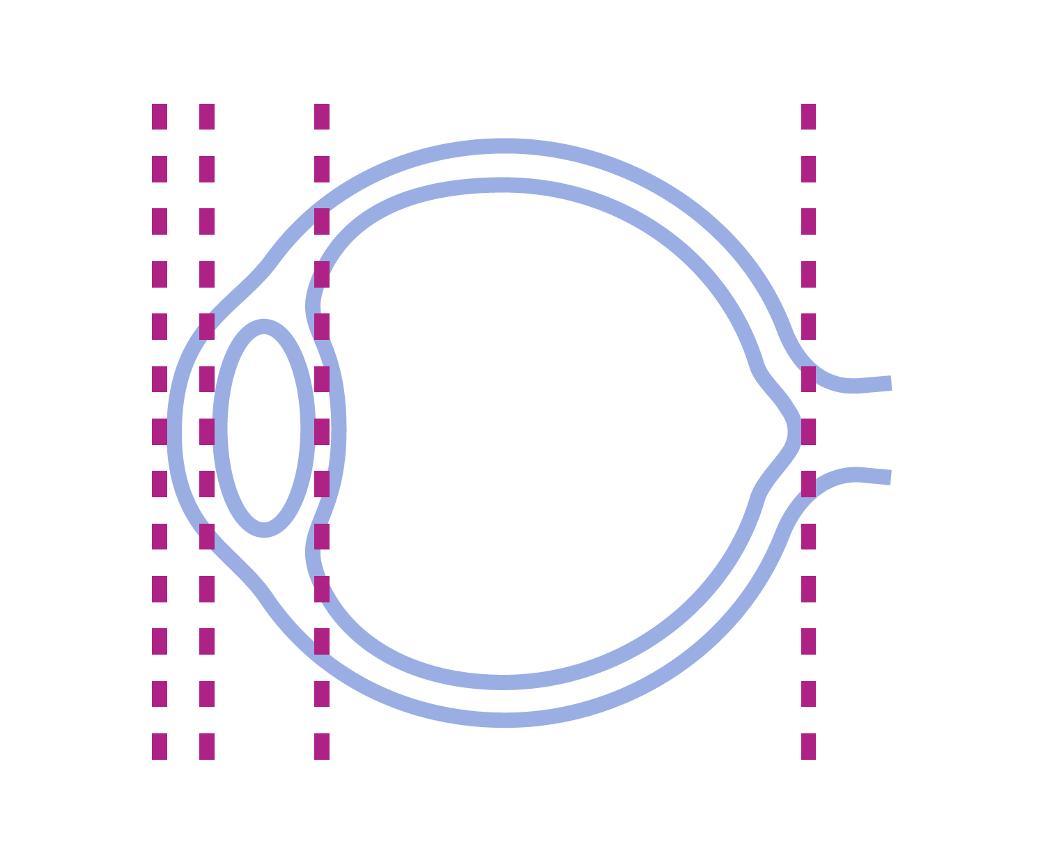 Location of inflammation