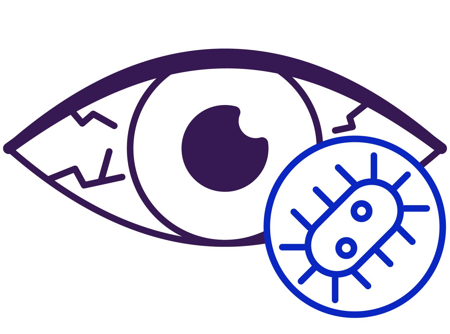 Prior eye infections or trauma