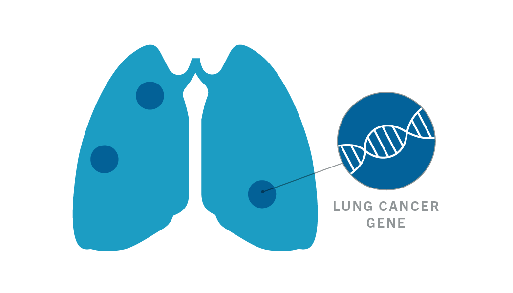 Different types of lung cancer are caused by mutations in different genes. Doctors can test which type of lung cancer a person has by looking at mutations in DNA taken from a biopsy of a tumor in the lungs.