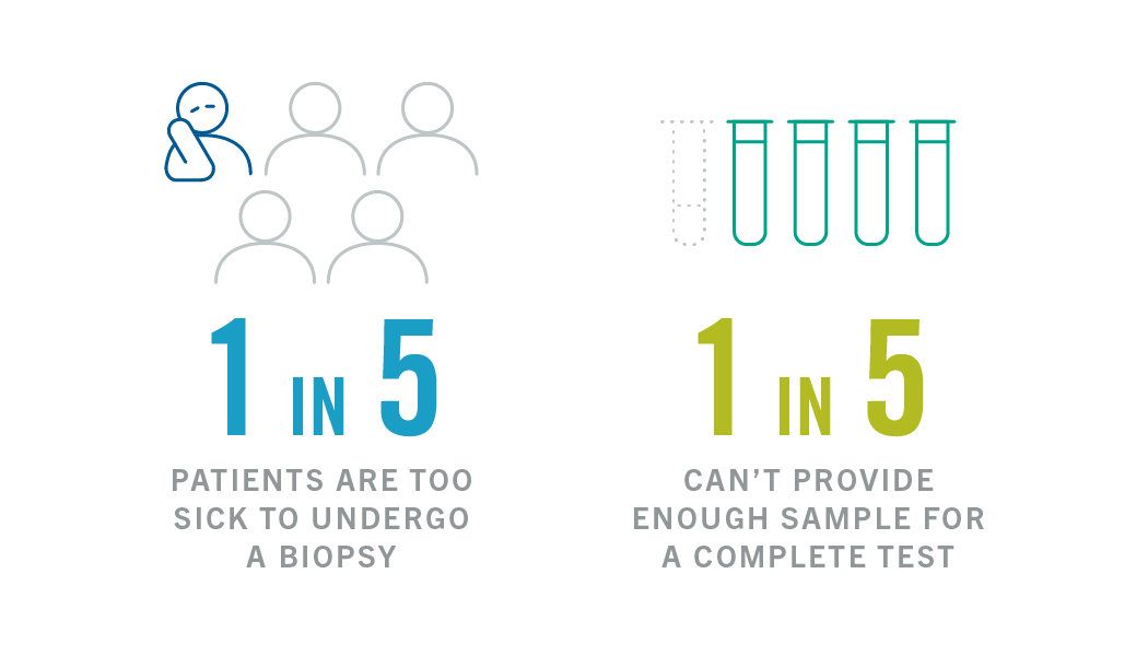 But up to 1 in 5 people with advanced lung cancer are too sick to undergo a biopsy.<sup>1</sup> Additionally, doctors can’t collect enough sample from 1 in 5 people to completely test for different types of lung cancer.<sup>2,3</sup>