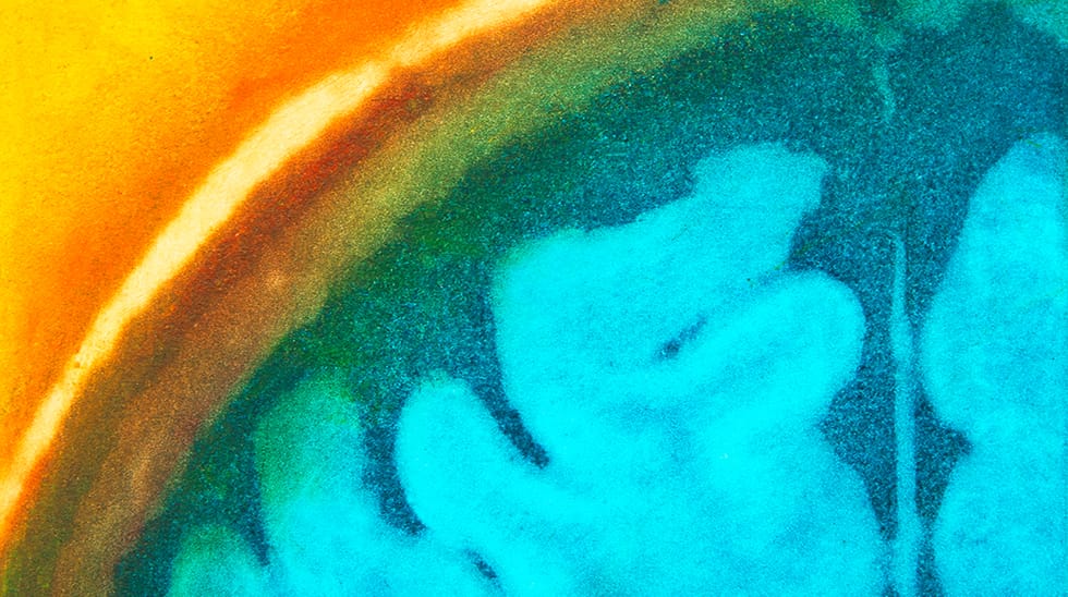 Understanding MS Progression