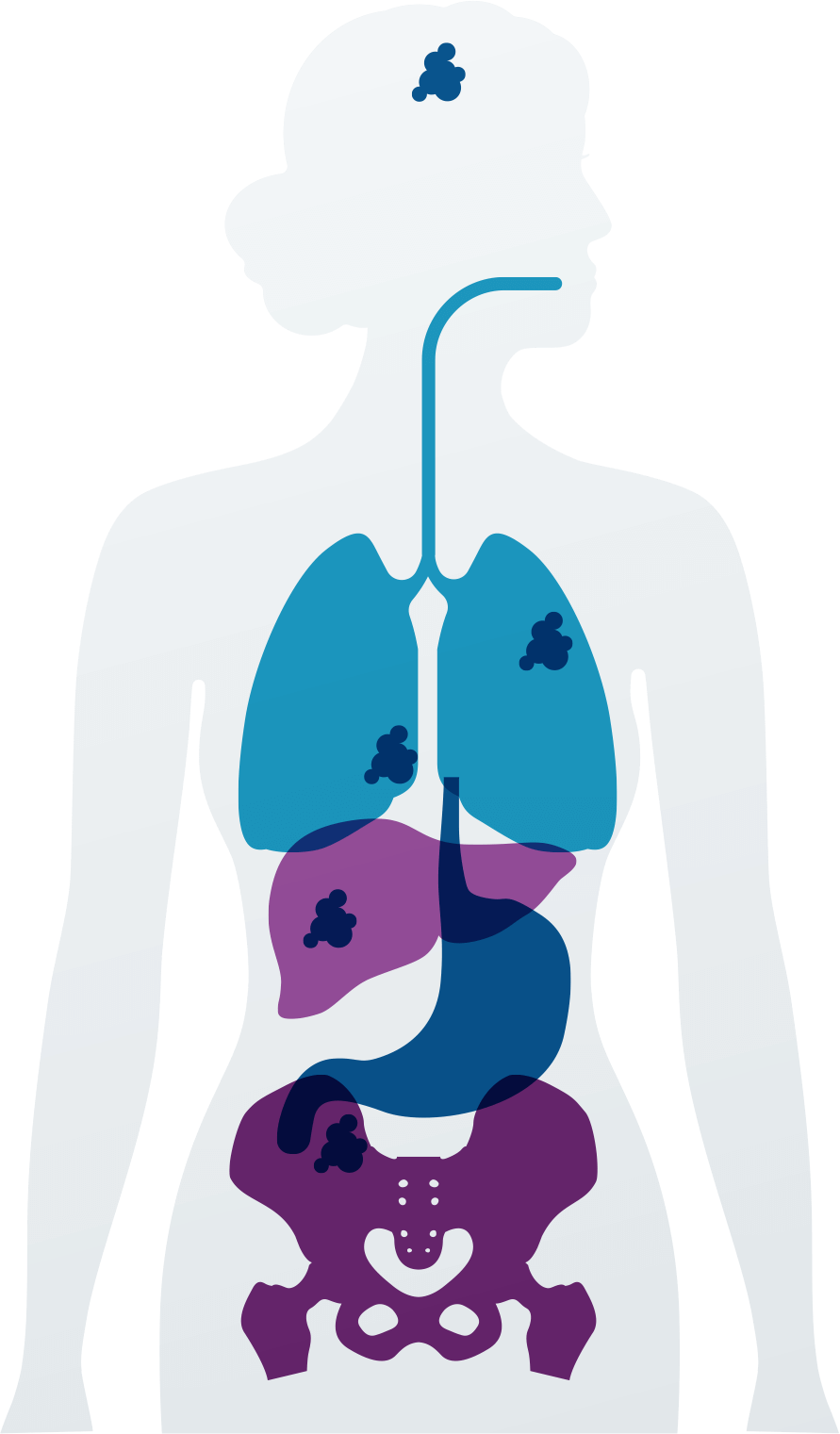 Definition of breast - NCI Dictionary of Cancer Terms - NCI