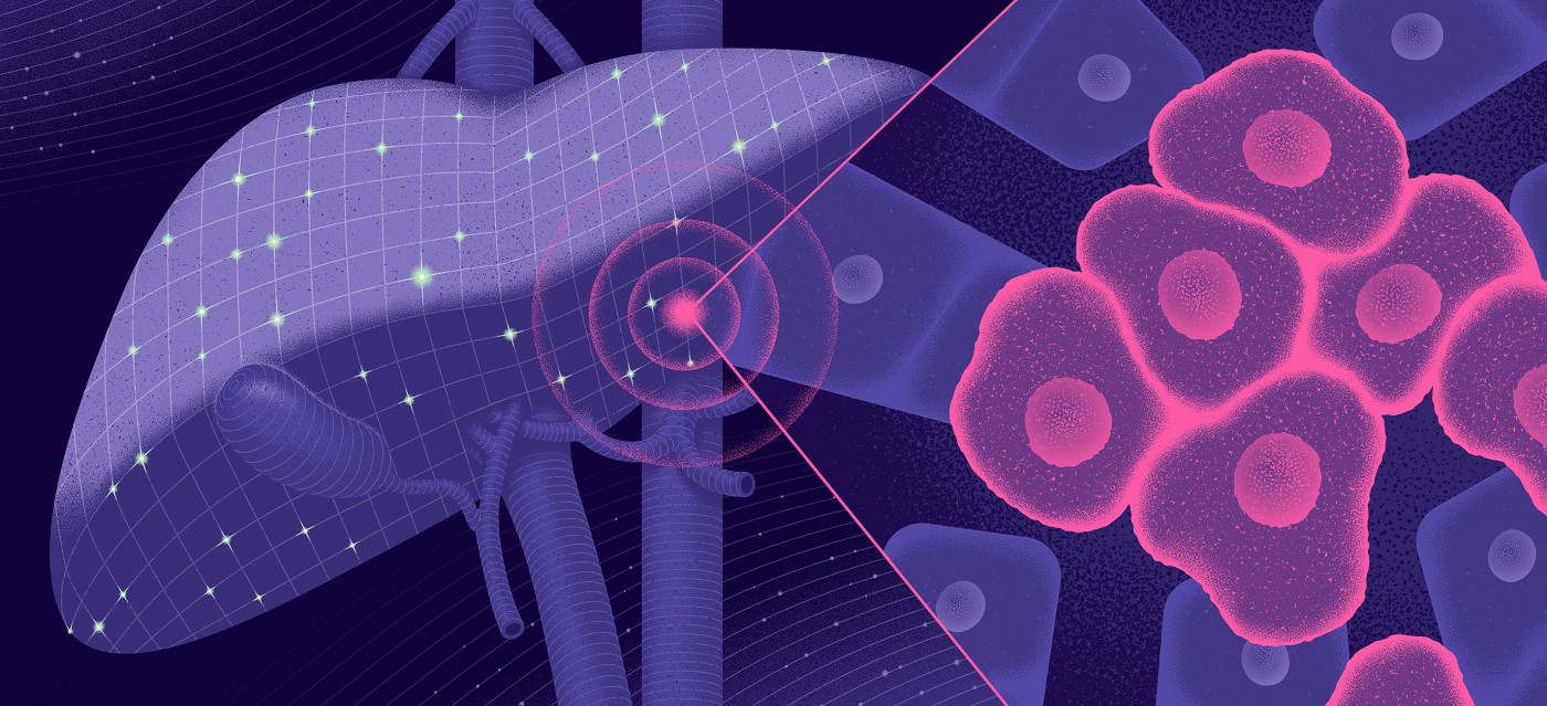 genentech-taking-on-liver-cancer